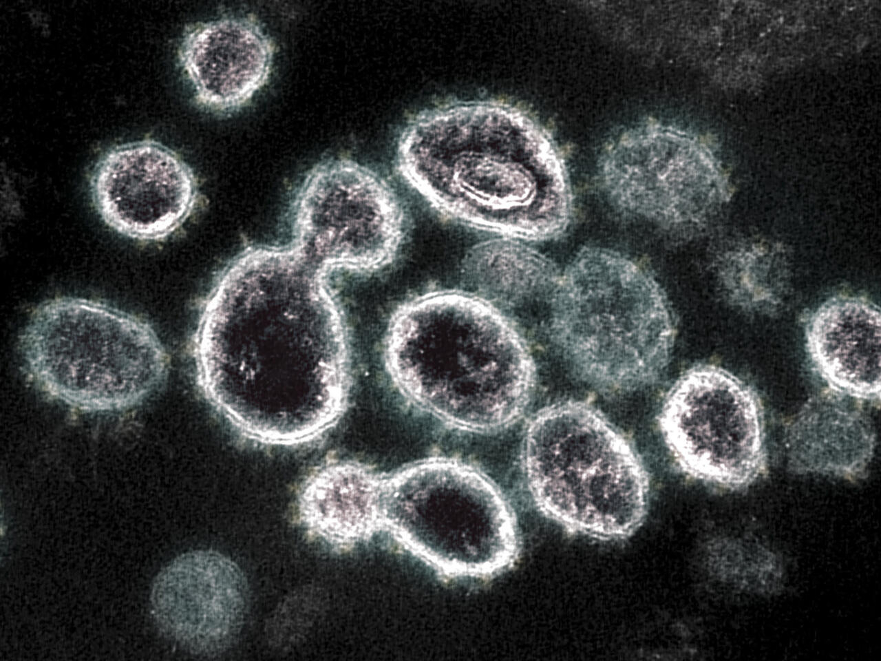 خلايا مصابة بفيروس كوفيد 19